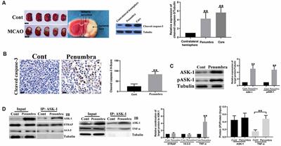 Mixed Lineage Leukemia 1 Promoted Neuron Apoptosis in Ischemic Penumbra via Regulating ASK-1/TNF-α Complex